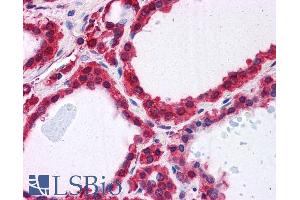 Immunohistochemistry (IHC) image for anti-Parkinson Protein 7 (PARK7) (C-Term) antibody (ABIN184951)