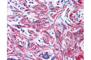 Anti-MYL9 antibody IHC of human smooth muscle. (MYL9 antibody  (AA 12-27))