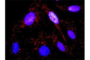 Proximity Ligation Analysis of protein-protein interactions between SYK and CTTN. (SYK antibody  (AA 1-635))
