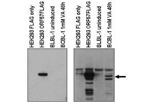Image no. 1 for anti-Herpes Virus Type 8 (HHV8) (C-Term) antibody (ABIN401445) (HHV8 antibody  (C-Term))