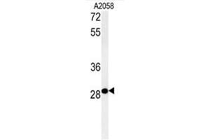 C11orf46 Antibody (C-term) western blot analysis in A2058 cell line lysates (35µg/lane). (C11orf46 antibody  (C-Term))