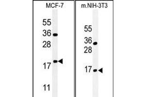 (LEFT)Western blot analysis of BTG1 Antibody (Center) (ABIN651304 and ABIN2840179) in MCF-7 cell line lysates (35 μg/lane). (BTG1 antibody  (AA 92-118))