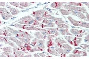 Desmoplakin antibody  (AA 2609-2822)