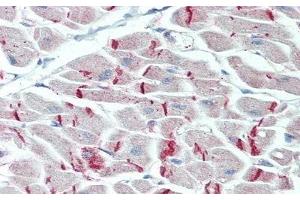 Detection of DSP in Human Heart Tissue using Polyclonal Antibody to Desmoplakin (DSP) (Desmoplakin antibody  (AA 2609-2822))