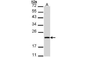 WB Image Sample (30 ug of whole cell lysate) A: A431 , 12% SDS PAGE antibody diluted at 1:1000 (DIABLO antibody)