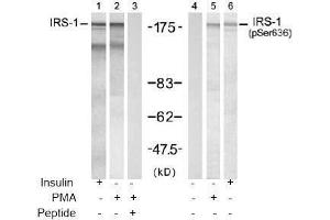 Image no. 2 for anti-Insulin Receptor Substrate 1 (IRS1) (pSer636) antibody (ABIN196979) (IRS1 antibody  (pSer636))