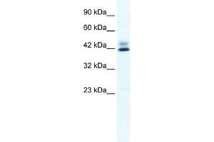 Western Blot showing ZNF551 antibody used at a concentration of 1-2 ug/ml to detect its target protein.