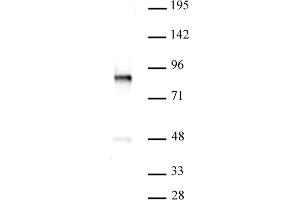 PKC-B antibody (pAb) tested by Western blot. (PKC beta antibody  (C-Term))