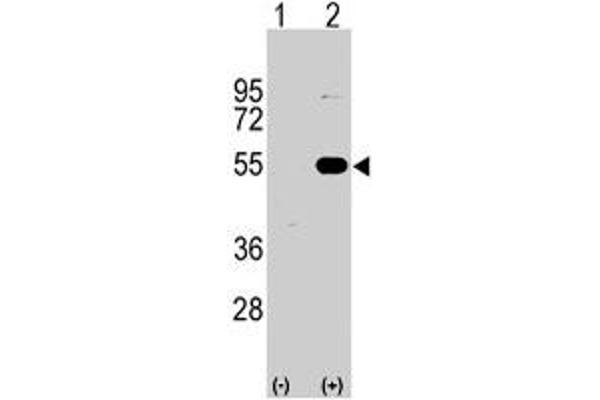 SPRED1 Antikörper  (N-Term)