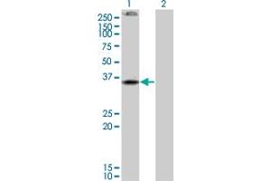 Western Blot analysis of CNR2 expression in transfected 293T cell line by CNR2 monoclonal antibody (M01), clone 3C7. (CNR2 antibody  (AA 302-360))