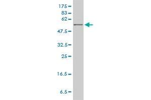 HPRT1 monoclonal antibody (M01), clone 4C3-G8 Western Blot analysis of HPRT1 expression in MCF-7 . (HPRT1 antibody  (AA 1-218))