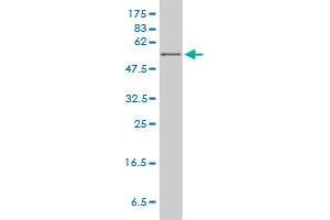 HPRT1 monoclonal antibody (M01), clone 4C3-G8 Western Blot analysis of HPRT1 expression in MCF-7 .