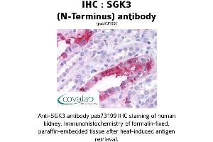 Image no. 1 for anti-serum/glucocorticoid Regulated Kinase Family, Member 3 (SGK3) (N-Term) antibody (ABIN1739229) (SGK3 antibody  (N-Term))