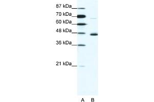 WB Suggested Anti-NEUROD1 Antibody Titration:  1. (NEUROD1 antibody  (N-Term))