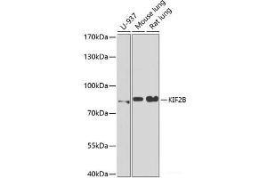 Western blot analysis of extracts of various cell lines using KIF2B Polyclonal Antibody at dilution of 1:1000. (KIF2B antibody)