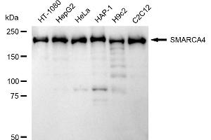 Western blotting analysis using SMARCA4 antibody (ABIN7800476).