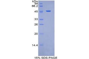 SDS-PAGE analysis of Human Plasminogen Protein. (PLG Protein)