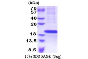 SDS-PAGE (SDS) image for Ribosomal Protein S18 (RPS18) (AA 1-152) protein (His tag) (ABIN5853308)