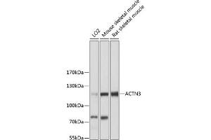 Western blot analysis of extracts of various cell lines, using  antibody  at 1:3000 dilution.