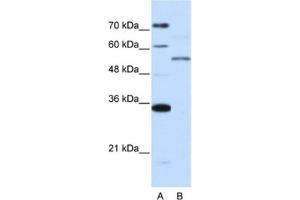 Western Blotting (WB) image for anti-Zinc Finger Protein 707 (ZNF707) antibody (ABIN2462009) (ZNF707 antibody)
