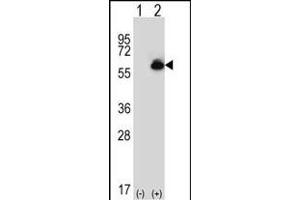 Western blot analysis of ALDH4A1 (arrow) using rabbit polyclonal ALDH4A1 Antibody (C-term) (ABIN392356 and ABIN2841995).