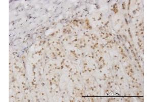 Immunoperoxidase of monoclonal antibody to EIF2AK2 on formalin-fixed paraffin-embedded human adrenal gland. (EIF2AK2 antibody  (AA 1-100))