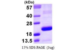 SDS-PAGE (SDS) image for Prostaglandin D2 Synthase (PTGDS) (AA 23-190) protein (His tag) (ABIN667417)