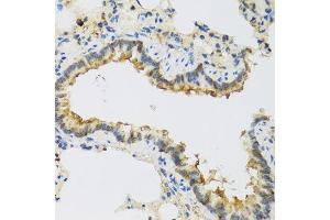 Immunohistochemistry of paraffin-embedded rat lung using FAM20A antibody (ABIN5974869) at dilution of 1/100 (40x lens).