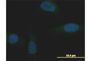 Immunofluorescence of monoclonal antibody to MXI1 on U-2 OS cell. (MXI1 antibody  (AA 1-182))