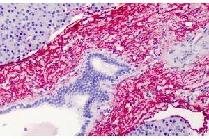 Human Pancreas: Formalin-Fixed, Paraffin-Embedded (FFPE) (Elastin antibody)