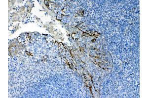 IHC analysis of Cytokeratin 8 using anti- Cytokeratin 8 antibody . (KRT8 antibody  (AA 107-325))