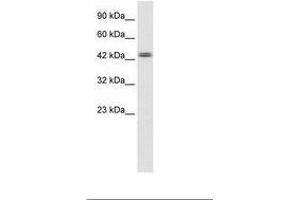 Image no. 2 for anti-tyrosyl-DNA phosphodiesterase 2 (TDP2) (AA 154-203) antibody (ABIN6735942) (TDP2 antibody  (AA 154-203))