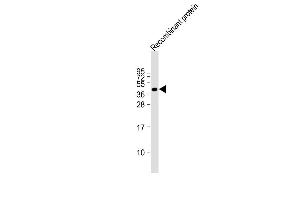 FAT4 recombinant protein at 20 µg per lane, probed with bsm-51360M FAT4 (1654CT645. (FAT4 antibody)