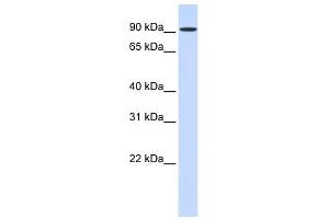 HSPH1 antibody used at 1 ug/ml to detect target protein. (HSPH1 antibody  (Middle Region))