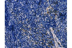 ABIN6266100 and ABIN6278545 at 1/100 staining mouse spleen tissue by IHC-P. (ZNF598 antibody  (N-Term))