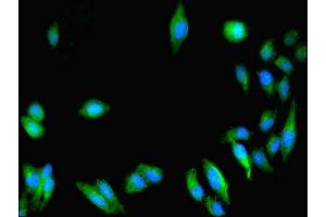 Immunofluorescent analysis of Hela cells using ABIN7154769 at dilution of 1:100 and Alexa Fluor 488-congugated AffiniPure Goat Anti-Rabbit IgG(H+L) (GUCY1A1 antibody  (AA 20-152))