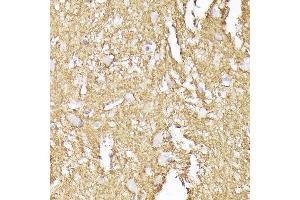 Immunohistochemistry of paraffin-embedded human brain using Synaptophysin Rabbit pAb (ABIN6135349, ABIN6148783, ABIN6148784 and ABIN6221958) at dilution of 1:200 (40x lens). (Synaptophysin antibody  (AA 150-250))
