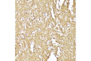 Immunohistochemistry of paraffin-embedded human brain using Synaptophysin Rabbit pAb (ABIN6135349, ABIN6148783, ABIN6148784 and ABIN6221958) at dilution of 1:200 (40x lens). (Synaptophysin antibody  (AA 150-250))