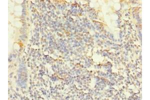 Immunohistochemistry (IHC) image for anti-Phosphatidic Acid Phosphatase Type 2C (PPAP2C) (AA 109-162) antibody (ABIN7163353)