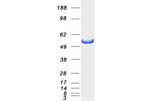 Validation with Western Blot (ALDH7A1 Protein (Myc-DYKDDDDK Tag))