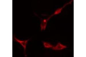 ABIN6275895 staining  Hela cells by IF/ICC.