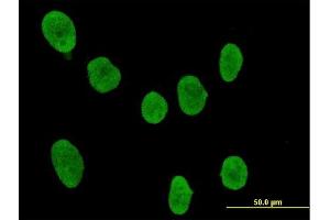 Immunofluorescence of purified MaxPab antibody to SOCS4 on HeLa cell. (SOCS4 antibody  (AA 1-440))
