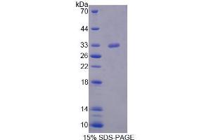 SDS-PAGE (SDS) image for serine/threonine Kinase 11 (STK11) (AA 49-309) protein (His tag) (ABIN6237533) (LKB1 Protein (AA 49-309) (His tag))