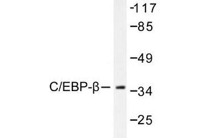 Image no. 1 for anti-CCAAT/enhancer Binding Protein (C/EBP), beta (CEBPB) antibody (ABIN265332) (CEBPB antibody)
