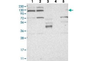 Western blot analysis of Lane 1: RT-4, Lane 2: U-251 MG, Lane 3: Human Plasma, Lane 4: Liver, Lane 5: Tonsil with KIF4A polyclonal antibody  at 1:250-1:500 dilution.