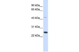 Western Blotting (WB) image for anti-Family With Sequence Similarity 119A (FAM119A) antibody (ABIN2459591)