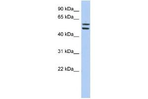 Western Blotting (WB) image for anti-Zinc Finger Protein 513 (ZNF513) antibody (ABIN2458444) (ZNF513 antibody)
