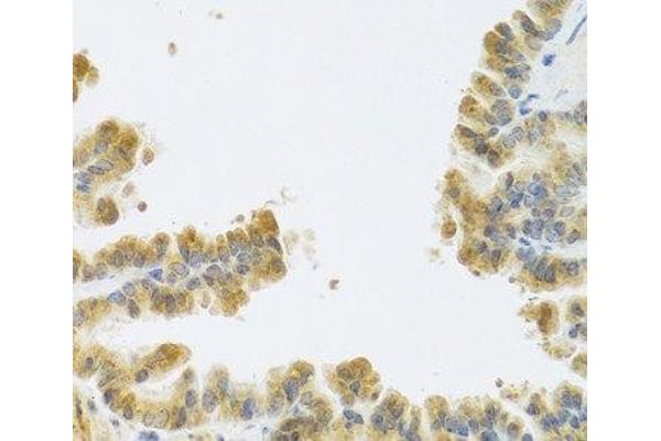 Neuromedin U antibody