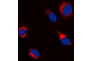 Immunofluorescent analysis of Beta-tubulin staining in Jurkat cells.