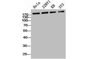 Western Blot analysis of HELA 22RV1 KB NIH-3T3 cells using Phospho-IRS-1 (S636) Polyclonal Antibody (IRS1 antibody  (pSer636))